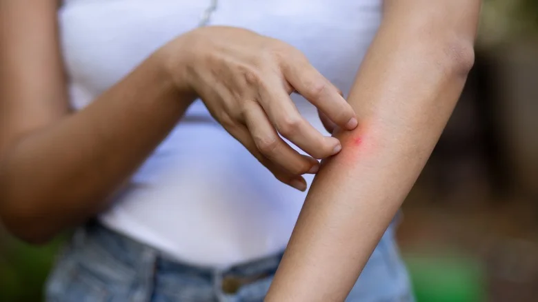 The Spice You’ll Want On Hand To Treat Bug Bites While Gardening